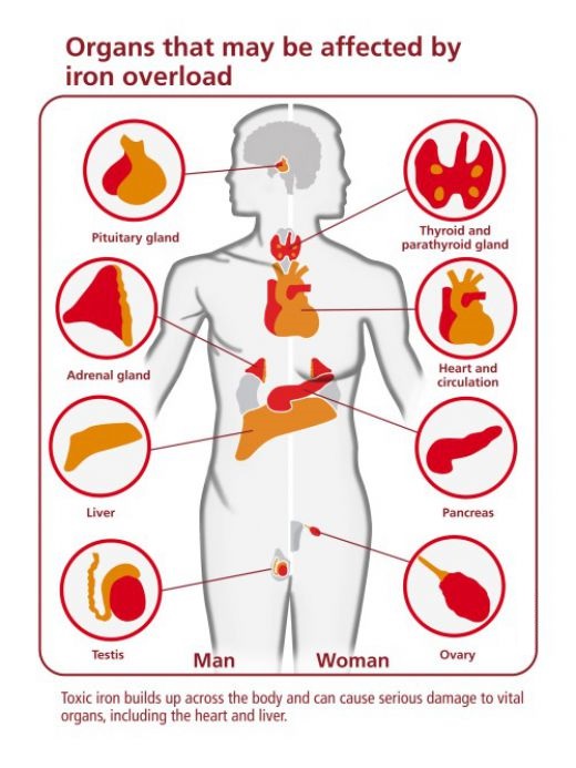 Thalassemia Homeopathic Treatment